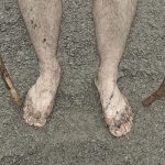 Bare Feet of Croagh Patrick pilgrim